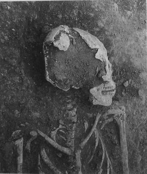 142. Погребение 60 из Сан-Хосе-Моготе, женщина фазы Росарио с жадеитовыми украшениями и прямой табулярной деформацией черепа.