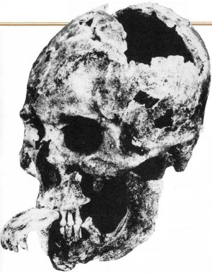 Человеку культуры Адена, череп которого был найден в маунде в Кентукки, были удалены верхние зубы. Это было сделано при его жизни, чтобы он мог вставлять себе в рот верхнюю челюсть волка. Веро­ятно, этот человек был шаманом и но­сил ее в качестве волчьей маски во время ритуалов или церемоний. Челюсть могла использоваться также для обряда "превра­щения", когда человек должен был перево­плотиться в волка.