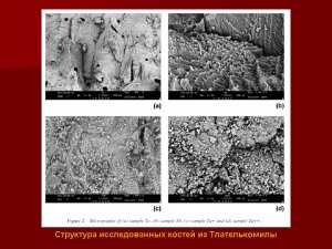 Структура исследованных костей. “Thermal Alterations In Archaeological Bones” in Archaeometry 49, 4 (2007).